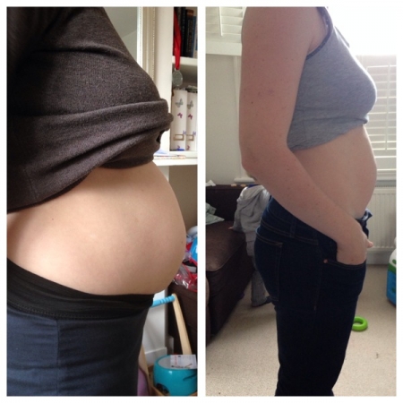 Successful Holistic Diastasis Healing Client of HCR Coach Kate Smart in London