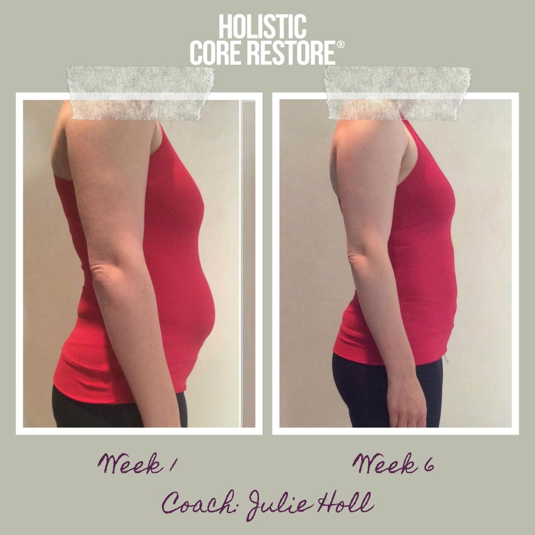 Before And After Diastasis Recti Repair Gallery Holistic Core Restore